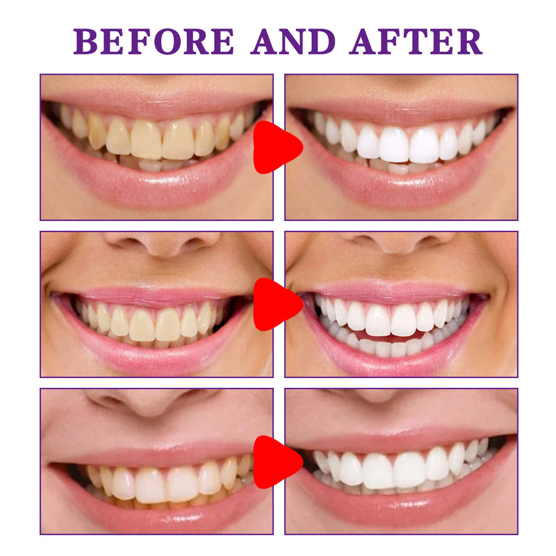 Purple Bright White Tooth Cleanser